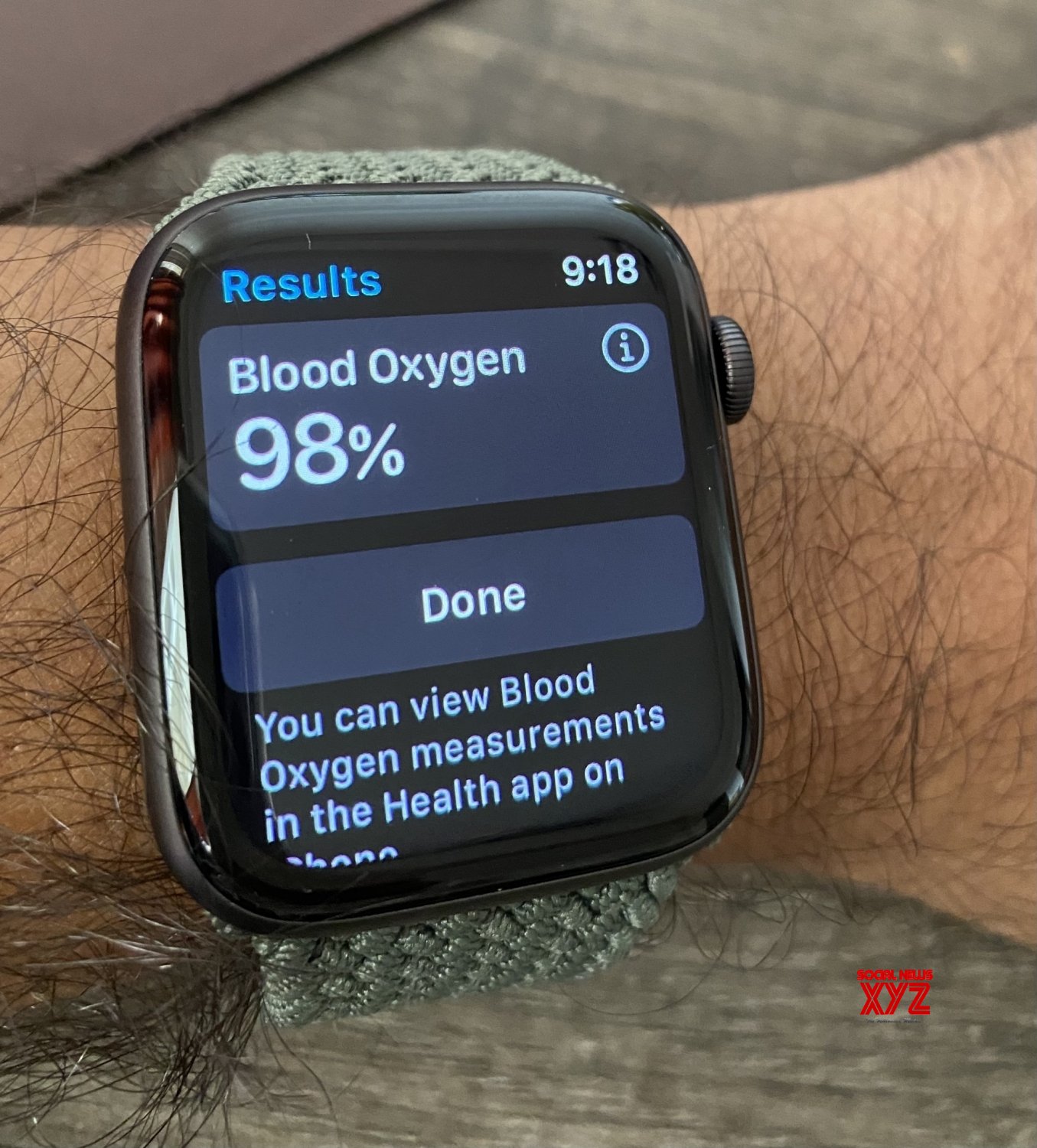 Doctor uses Apple Watch’s banned blood O2 feature to save passenger mid-air